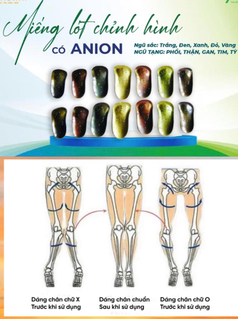 Miếng Lót Chỉnh Hình 